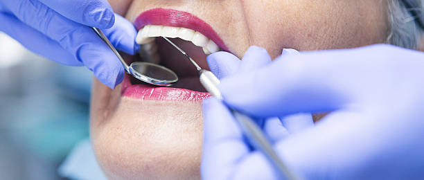 Best Emergency Root Canal Therapy in Castle Point, MO